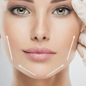 Masseter Botox