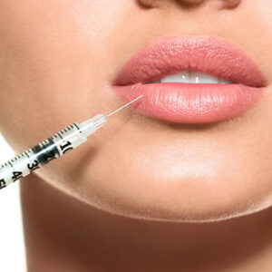 Lip Filler